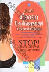 ข่าวดี! เนื้องอกช็อกโกแลตซีสต์ ไม่ต้องกลัวอีกต่อไป : STOP! Chocolate Cyst &amp; Uterine Tumor